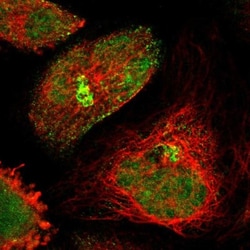 GRHL1 Antibody, Novus Biologicals:Antibodies:Primary Antibodies